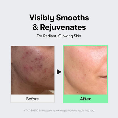 CICA Reedle Shot 100 Microneedling Serum