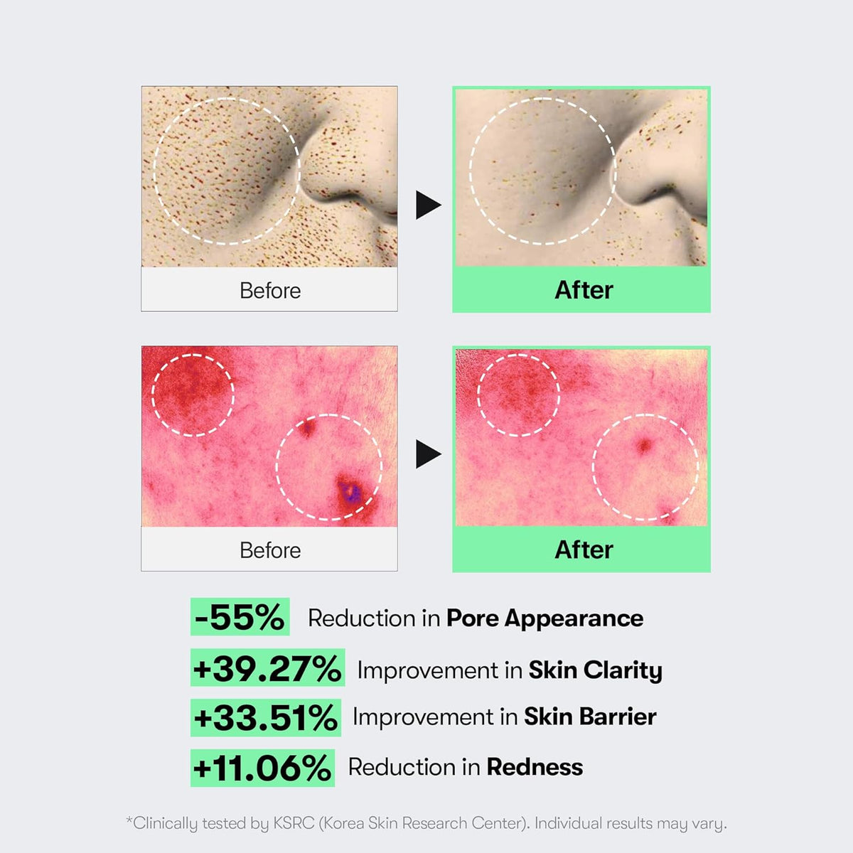 CICA Reedle Shot 100 Microneedling Serum