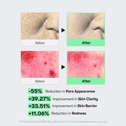 CICA Reedle Shot 100 Microneedling Serum